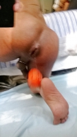 Fist