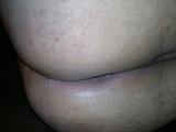 Anal Closed-Up