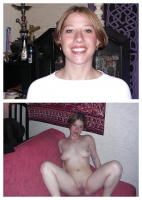 Before and After Teens Collection 1