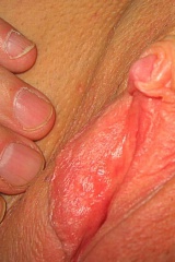 Big clit