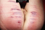 caning