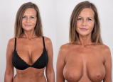 DRESSED UNDRESSED - 3