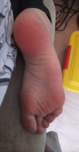soles