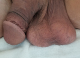 More low hanging balls