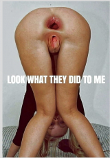anal hole