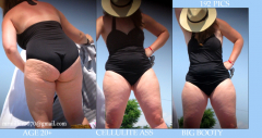BBW and SSBBW beach voyeur (My work) - N