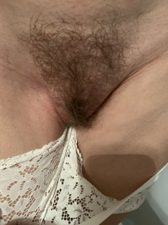 Hairy woman - gallery 3 - N