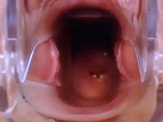 Webcam Pussy Play with Speculum